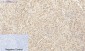 HSP A5 Polyclonal Antibody